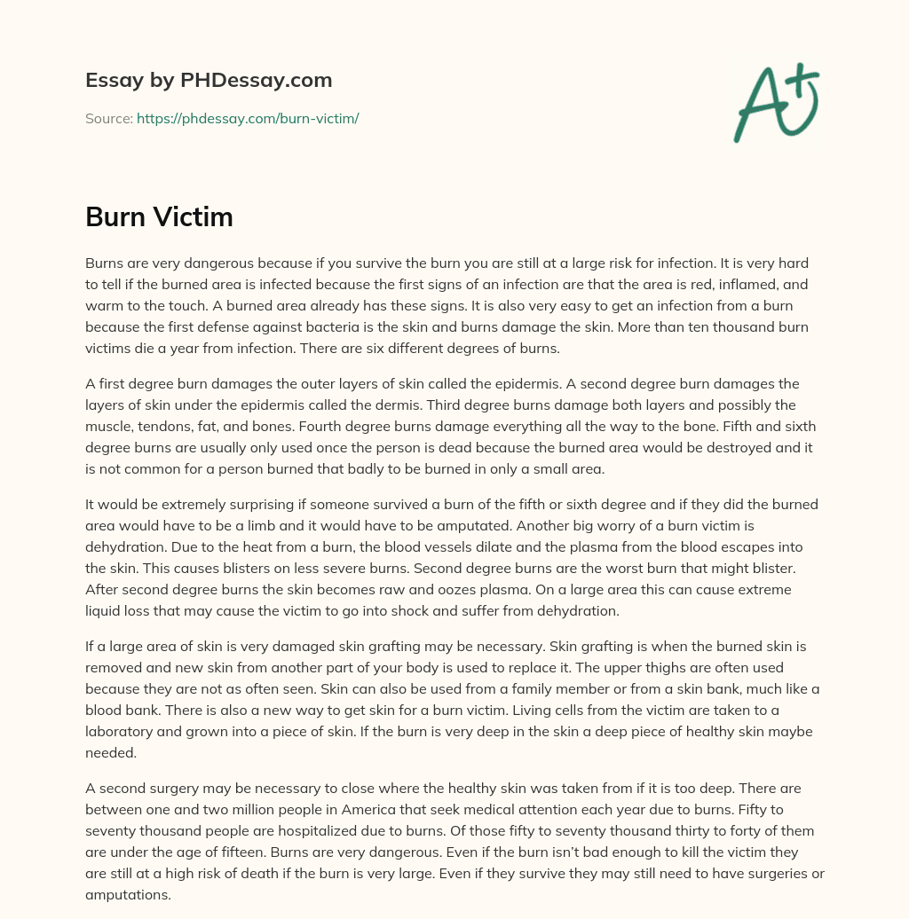 Burn Victim (500 Words)
