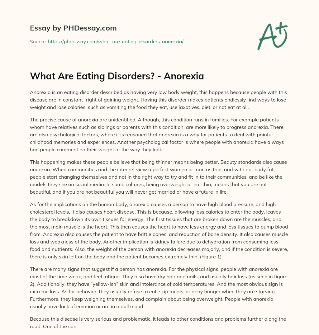 anorexia eating disorders essay